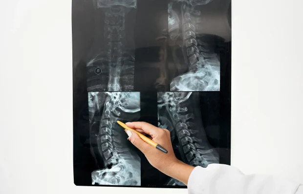 doctor-neurologist-looks-to-x-ray-image-of-the-pat-2025-09-14-16-21-10-utc-scaled-2